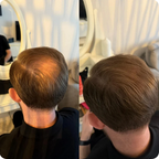 Verdichtendes Haarstreu – ORMAE
