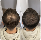 Verdichtendes Haarstreu – ORMAE