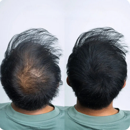 Poudre Capillaire Densifiante – ORMAE