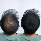 Verdichtendes Haarstreu – ORMAE