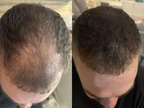 Verdichtendes Haarstreu – ORMAE