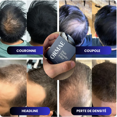 Poudre Capillaire Densifiante – ORMAE